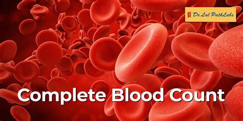 blood counting test|Complete blood count (CBC) .